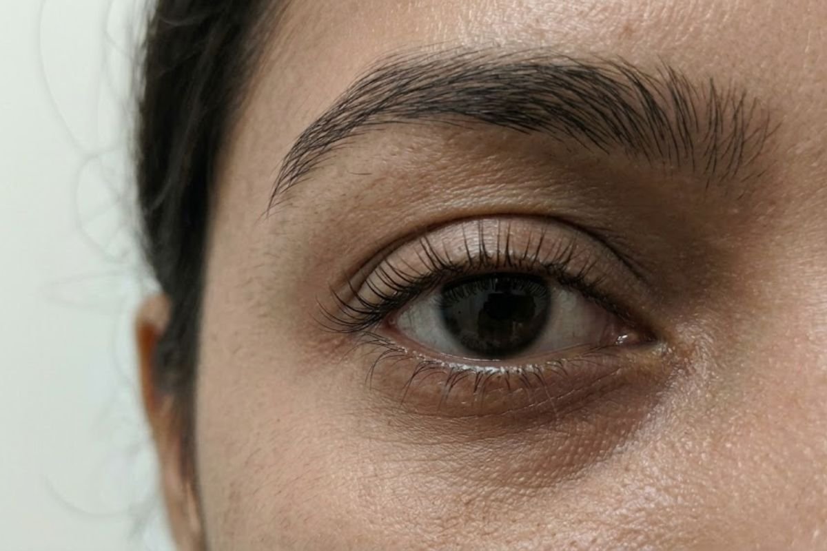 After treatment